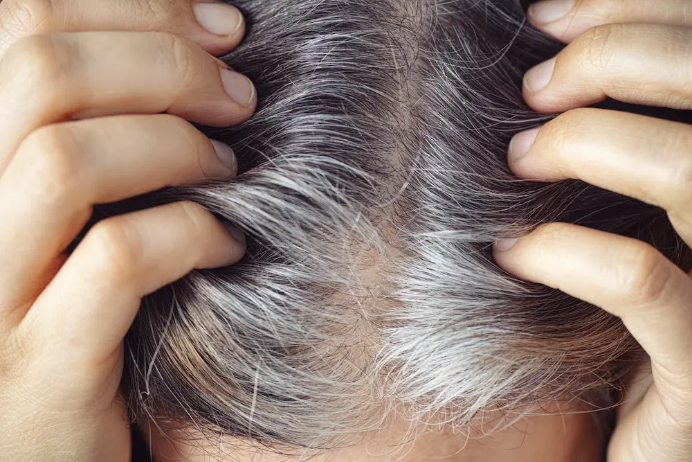 علت اصلی سفید شدن مو چیست؟ + ارائه 8 راهکار موثر
